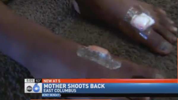 Sons Feet Wounded by Gunshot Sons Feet Wounded by Gunshot