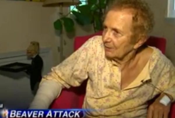 Beaver Attack 83 Year Old Woman